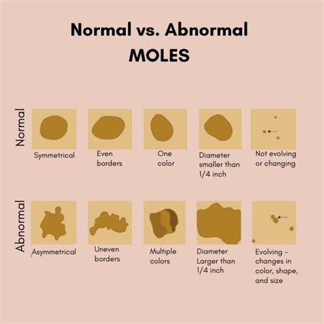 show me a picture of a mole|Normal moles pictures library 